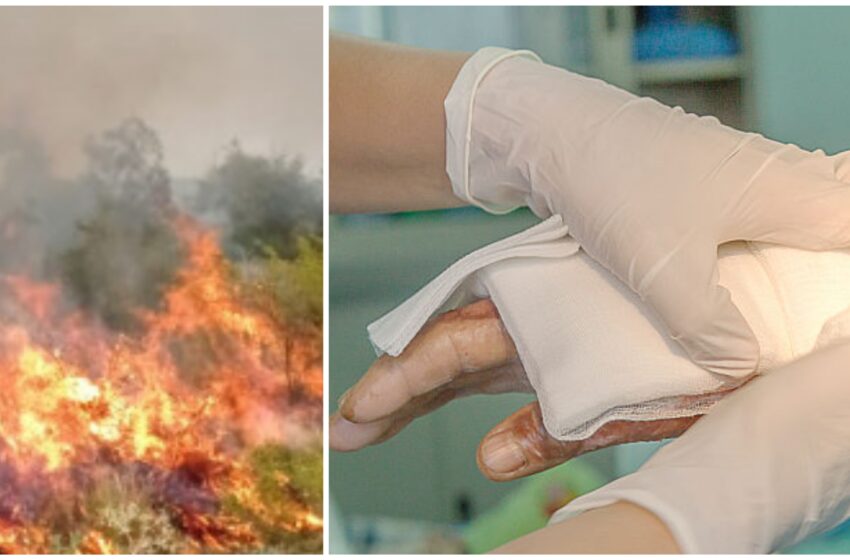  Braniștea. O femeie de 83 de ani a suferit arsuri de gradul I și II, încercând să stingă un incendiu de vegetație