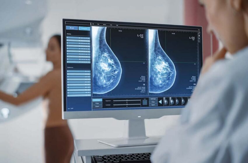  De marți, 25 februarie, se pot face programări pentru mamografii gratuite la Policlinica Bistrița