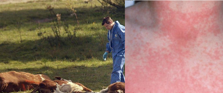  Nimic nou sub semnul epidemiilor: Antraxul și scarlatina au bântuit secolul trecut și prin actualul județ Bistrița-Năsăud