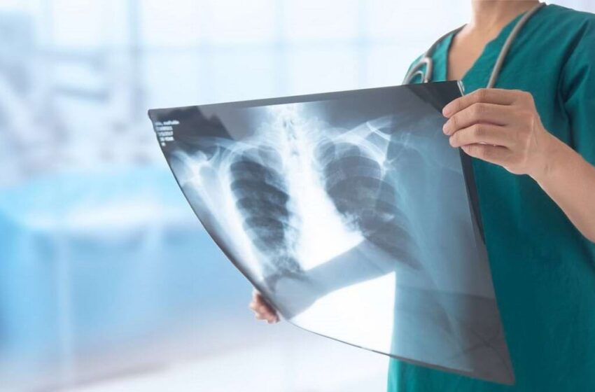  Încă 3 decese în ultima săptămână din cauza pneumoniei înregistrate în Bistrița-Năsăud
