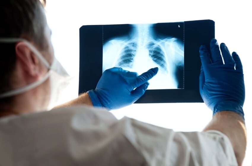  Alte două persoane de peste 65 de ani au murit după ce au făcut pneumonie