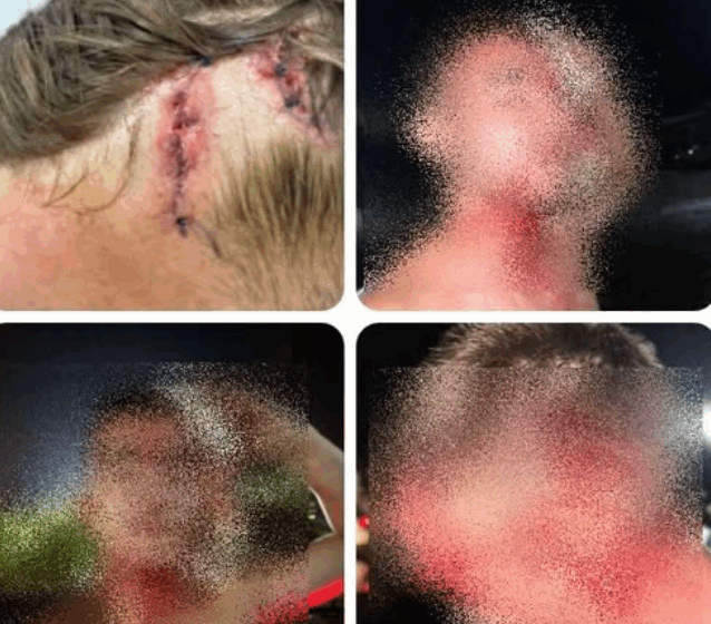  Bătăușii de la Feldru au fost reținuți. Cei doi au agresat mai mulți tineri și vor fi cercetați pentru violențe și distrugere