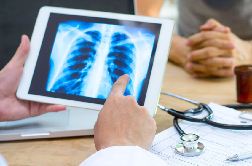  Persoană vârstnică din Bistrița-Năsăud decedată în urma unei pneumonii