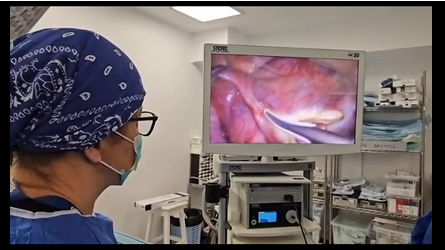  Caz rar operat la Spitalul Clinic Județean de Urgență Bistrița: un chist de 7 cm la o fetiță de 7 ani, îndepărtat laparoscopic