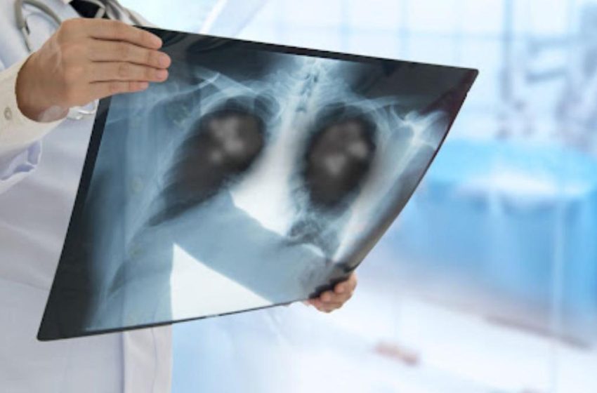  Val de îmbolnăviri respiratorii în Bistrița-Năsăud: șase decese într-o singură săptămână