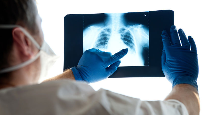  Două decese provocate de pneumonie în Bistrița-Năsăud. Sute de cazuri raportate într-o singură săptămână