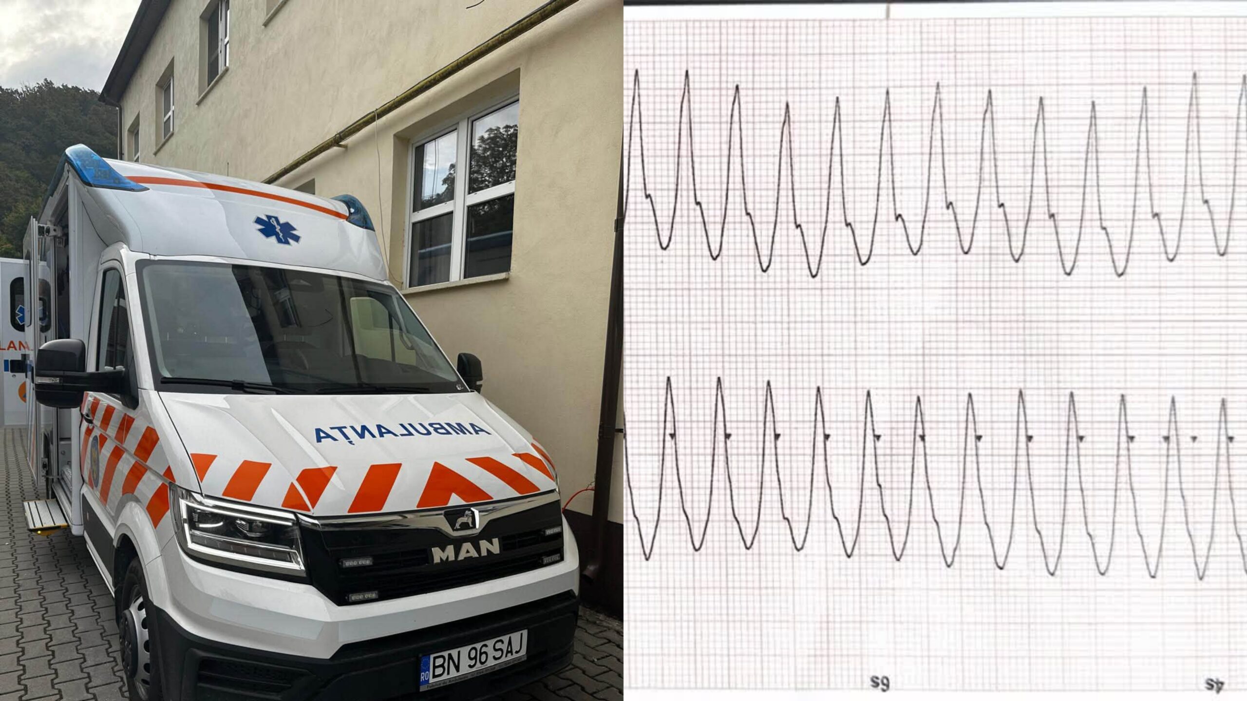  Pacient cu infarct, salvat în timpul transferului spre Cluj de echipajul SAJ Bistrița-Năsăud